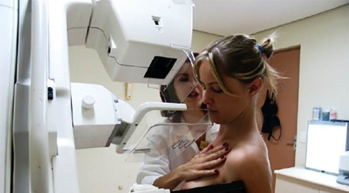 médica orienta mulher durante exame de mamografia; está com o seio no aparelho