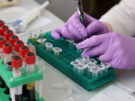 Outubro termina com 40 mil novos casos de coronavírus pessoa com luvas faz anotações sobre ampolas com sangue em bancada