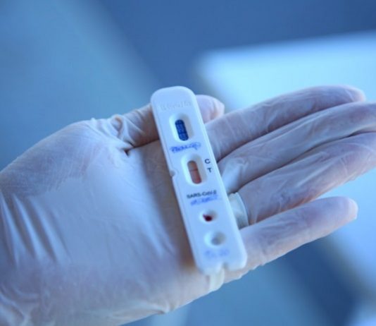 4 mil pessoas se recuperaram em SC da Covid-19, 109 faleceram pessoas usando luva segura um teste rápido de coronavírus