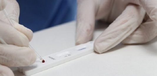 Governo de SC distribui 32 mil testes rápidos de coronavírus profissional de saúde usando luvas mexe em teste rápido