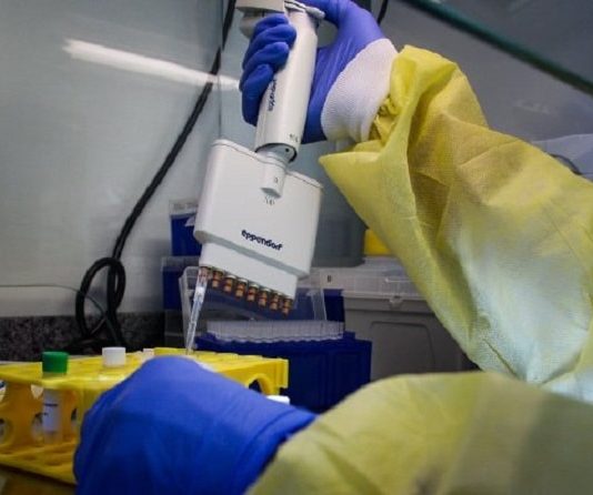 close em mãos de pessoa usando todos esquipamentos de proteção como luvas e macacão manipulando testes de coroanvírus