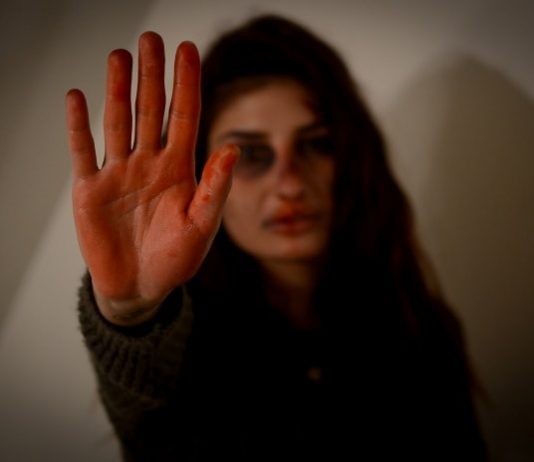 mulher estende a mão aberta em sinal de para na direção da câmera; ela tem hematomas no rosto
