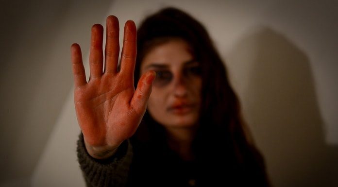 mulher estende a mão aberta em sinal de para na direção da câmera; ela tem hematomas no rosto