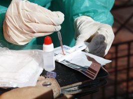 pessoa manipula com luvas amostra de sangue sobre teste rápido de coronavírus