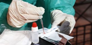 pessoa manipula com luvas amostra de sangue sobre teste rápido de coronavírus