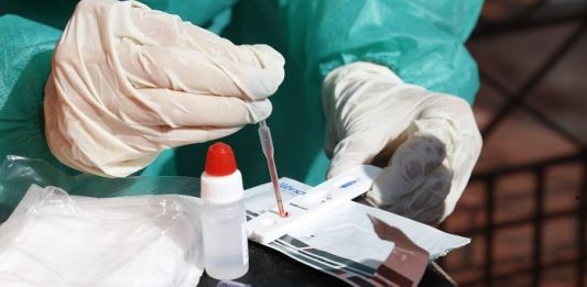 Estado teve 3 mil novos casos de coronavírus em uma semana pessoa manipula com luvas amostra de sangue sobre teste rápido de coronavírus