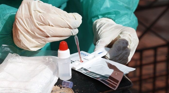pessoa manipula com luvas amostra de sangue sobre teste rápido de coronavírus