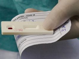 SC tem 812 mortes e 51 mil recuperados da Covid-19 mão segurando um papel e um teste de coronavírus
