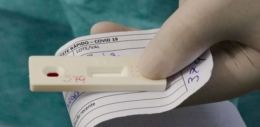 SC tem 812 mortes e 51 mil recuperados da Covid-19 mão segurando um papel e um teste de coronavírus