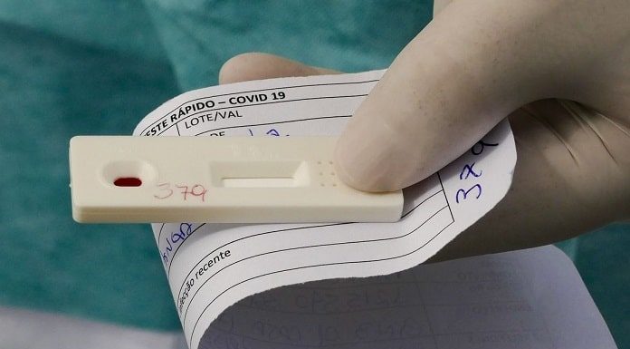 mão segurando um papel e um teste de coronavírus