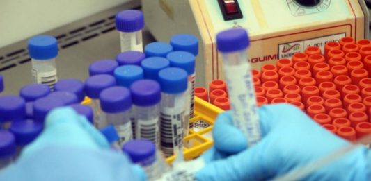 close em mãos com luvas que seguram ampolas de amostras e outras organizadas sobre bancada