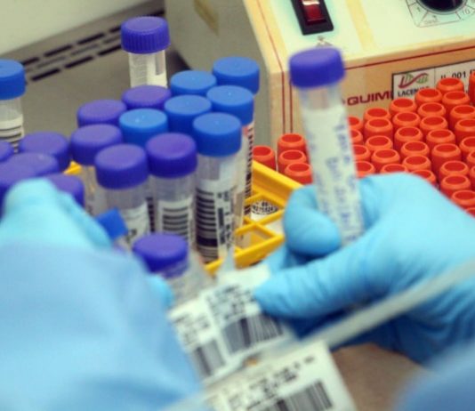 close em mãos com luvas que seguram ampolas de amostras e outras organizadas sobre bancada