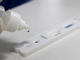 Cai o número de casos ativos de coronavírus em Santa Catarina teste rápido de coronavírus - cai o número de casos ativos em sc
