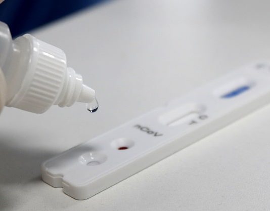 teste rápido covid - pessoas que pegaram coronavírus em santa catarina