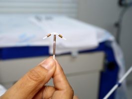 DIU: especialista lista mitos e verdades sobre o método contraceptivo Uma mão segura com a ponta dos dedos um DIU de cobre, ao fundo uma cama hospitalar. A foto ilustra a notícia de que mais de 1.700 DIUs já foram inseridos em mulheres da capital
