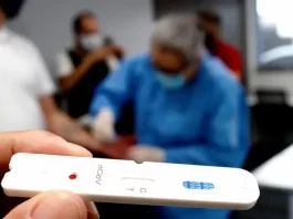 Estado distribui testes rápidos de Covid aos municípios com novos critérios Testes rápidos de Covid em SC