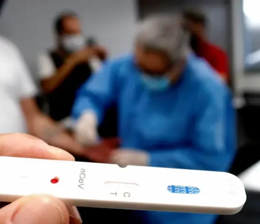 Estado distribui testes rápidos de Covid aos municípios com novos critérios Testes rápidos de Covid em SC